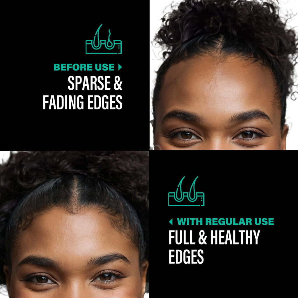 100% Unrefined Batana Oil 4oz